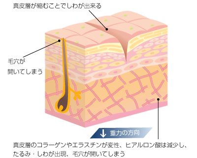 高濃度ビタミンC点滴