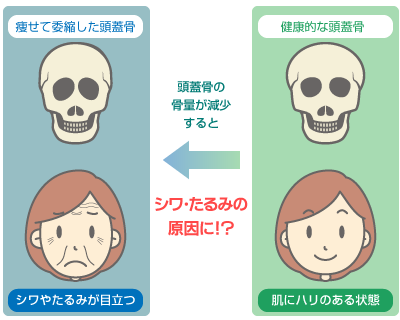 高濃度ビタミンC点滴