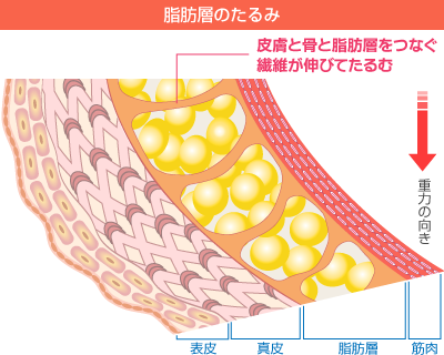 高濃度ビタミンC点滴